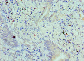 BIK Antibody