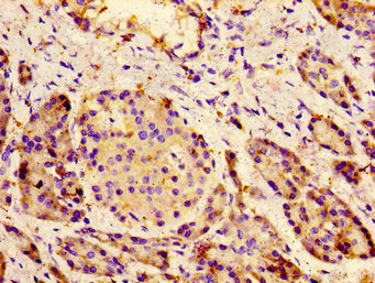 CACNA1C Antibody