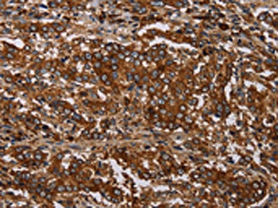 MAGEC2 Antibody