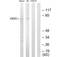 HKR1 Antibody