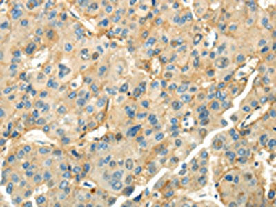 CD70 Antibody