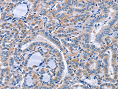 CD36 Antibody