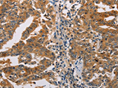 ACY1 Antibody
