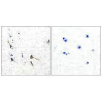 KCNC2 Antibody