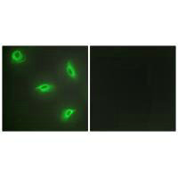 TNFSF14 Antibody