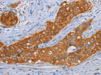 MMP1 Antibody