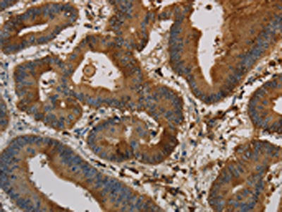 KRT16 Antibody