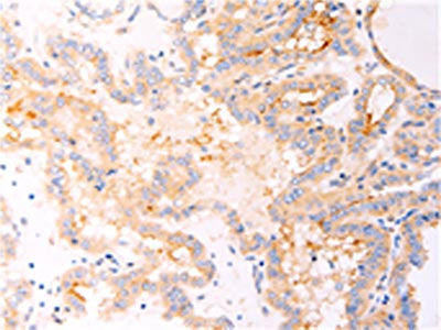 RELA Antibody