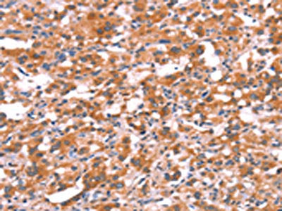 GABRG2 Antibody