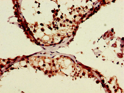 ZRSR2 Antibody