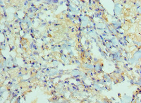 ADAM9 Antibody