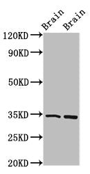 FOXE3 Antibody