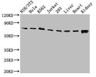 RIPK1 Antibody