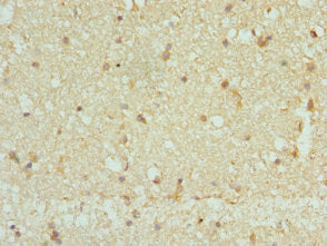 CAMK2B Antibody