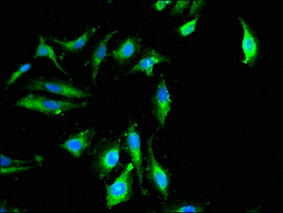 DGKZ Antibody