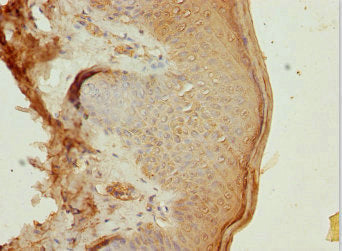 TRIM29 Antibody