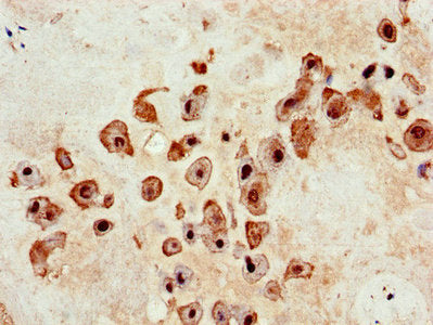 DOC2B Antibody