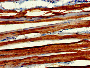 MYBPC2 Antibody