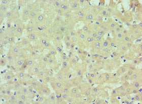 IL13RA2 Antibody