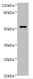 STARD3 Antibody