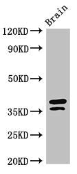 MAPRE2 Antibody