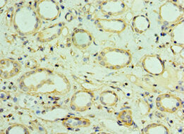 VAMP3 Antibody