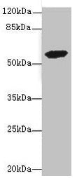 ETFDH Antibody