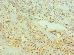 NTRK2 Antibody