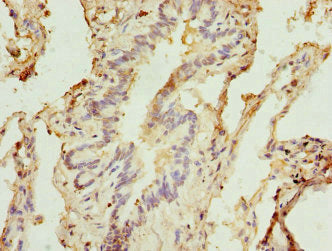 STX5 Antibody