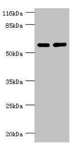 PPP2R5C Antibody