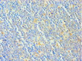 TCOF1 Antibody