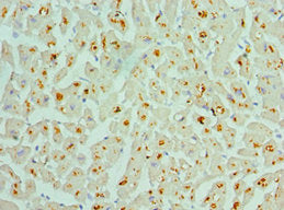ASAH1 Antibody