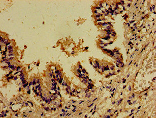 DOCK1 Antibody