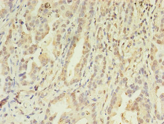 FGL2 Antibody