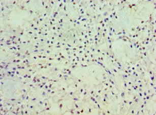 POSTN Antibody