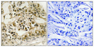 Phospho-MYB (Ser532) Antibody