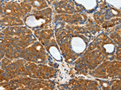 RPS6KB1 Antibody