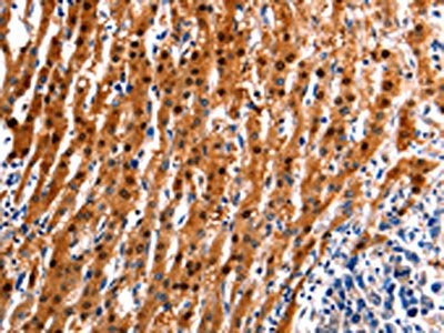 ID4 Antibody
