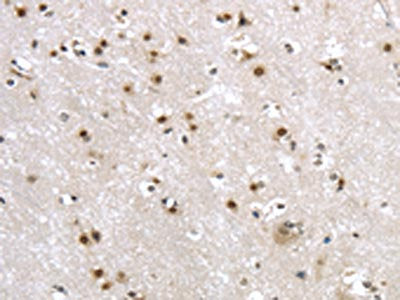 MRE11A Antibody