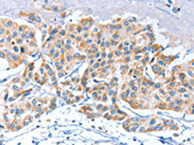 APOBEC3D Antibody