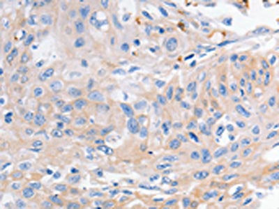 KCNA1 Antibody