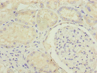 MED22 Antibody