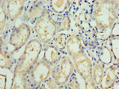 TAF1C Antibody