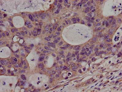 PKN2 Antibody