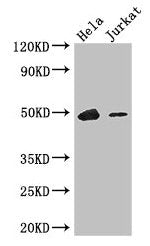 IKZF1 Antibody