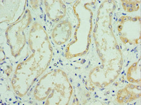 SLC39A6 Antibody