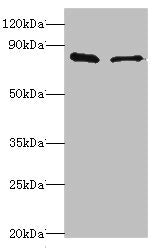SLC39A6 Antibody