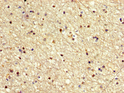 MECOM Antibody