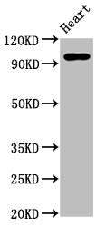 GRM2 Antibody