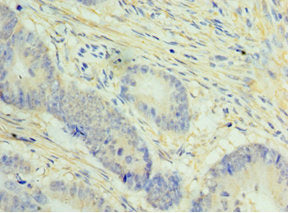 NCAPH Antibody
